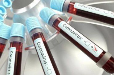 Кількість інфікованих коронавірусом COVID-19 на Закарпатті зросла до 375 осіб