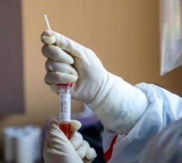 У 62 осіб у Мукачево підозрюють коронавірус COVID-19
