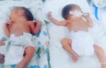Хлопчики-близнюки з’явилися на світ у день п’ятнадцятиріччя матері-породіллі