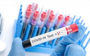 У Мукачево зафіксований свіжий випадок інфікування коронавірусом COVID-19
