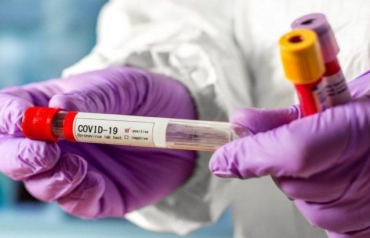 Кількість інфікованих COVID-19 на Закарпатті сягнула 2149 осііб