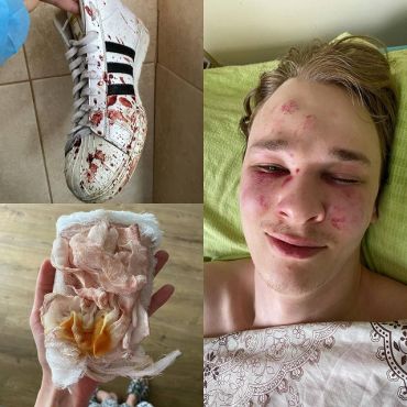 Выкрали из гостиницы: Парень порезал вены в ТЦК в Закарпатье 