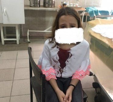 Жертва школьной травли в Закарпатье панически боится ходить в школу