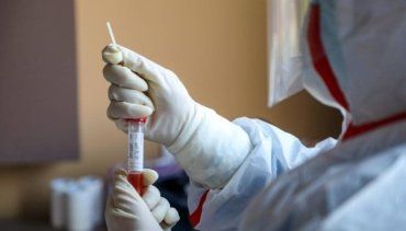 Где в Ужгороде бесплатно делают тест на коронавирус 