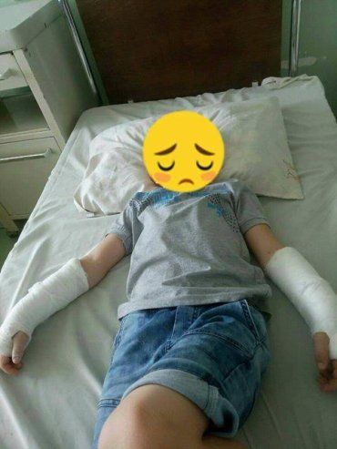 На Закарпатье 6-летний мальчик упал с дерева, высотой в 2 метра, и ему даже не вызвали скорую