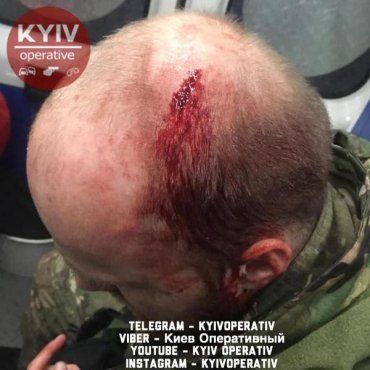 Цыган из Закарпатья не могут контролировать копы в Киеве 