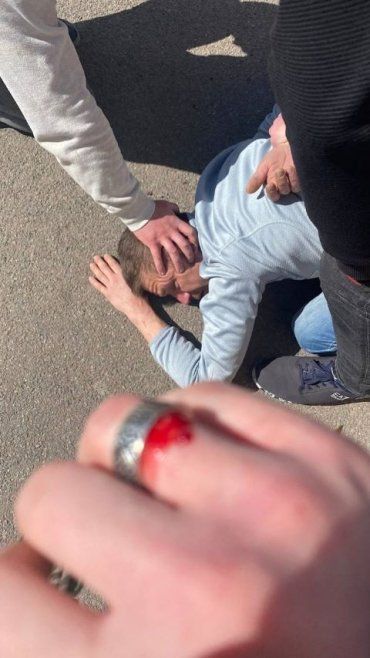 В центре Ужгорода 39-летний псих устроил потасовку с военнослужащей из теробороны 