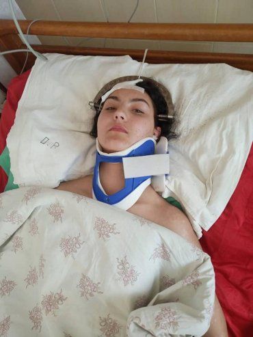 В Закарпатье просят помочь юной девушке, которая получила страшные травмы после ДТП