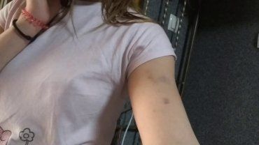 Синяки на шее, пояснице и на руках: В Закарпатье полицейский избил девушку 