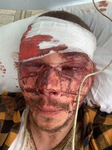 Шарий опубликовал фото своего однопартийца, которого избили животные из нацкорпуса