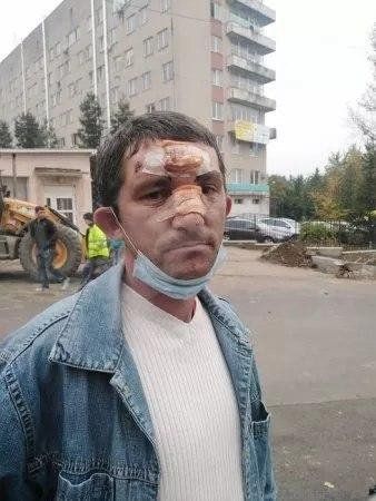 В Ужгороде нужны свидетели дикого поступка после которого человека пришлось оперировать 