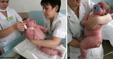 Этот новорождённый побил рекорд по весу - 18 кг