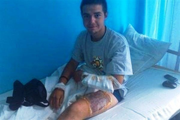 18-летний пограничник из Закарпатья Ваня Васько попал под обстрел "града"