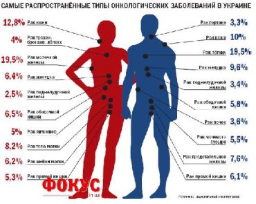 Самые распостраненные типы онкологических заболеваний в Украине