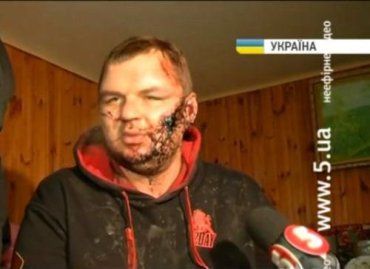 Лидер Автомайдана Булатов найден с отрезанным ухом