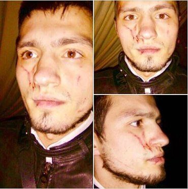 Ужгородские таксисты жестоко избили пассажира