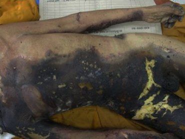 В Закарпатье жестоко убили и сожгли мужчину