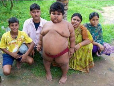 В Индии 5-летняя девочка весит 76 килограммов