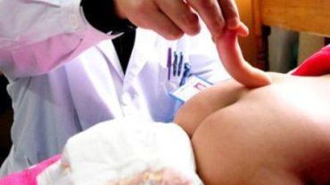 Китайские хирурги удалили девочке 12-см "конский хвост"