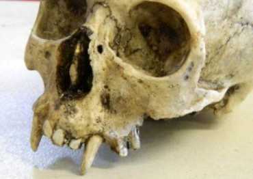 В могилах обнаружены изуродованные человеческие скелеты