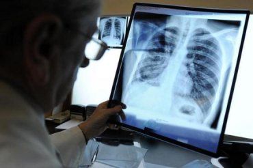 В Ужгороде растет количество больных с открытой формой туберкулеза