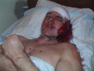 Житель Алушты Константин Пастухов получил 10 ударов ножом