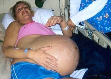 В Ужгороде женщины рожают по пять детей, - и это не предел!