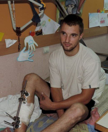 В Мукачевском госпитале 54 воина АТО с огнестрельным ранением