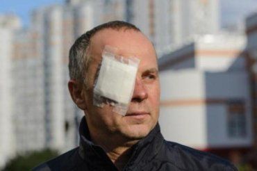 Шкиряк: милиция установила личности 14 человек, избивших Нестора Шуфрича