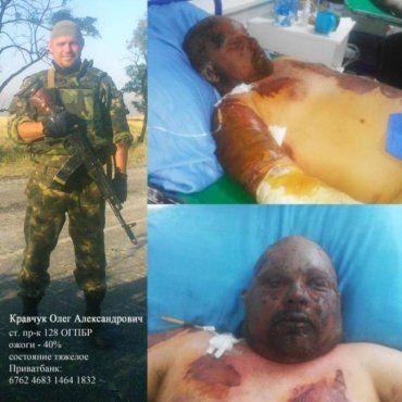 Олег Кравчук попал в харьковскую больницу после боев под Дебальцево