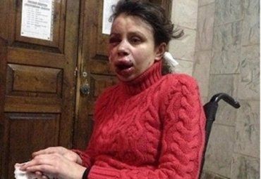 Избиение журналистки Татьяны Чорновил - это спецоперация ?