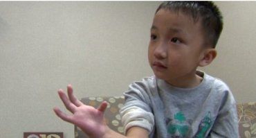 Хірурги зробили так,що у хлопчика з`явився великий палець