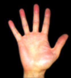 Длина пальцев на руке может многое сказать о человеке